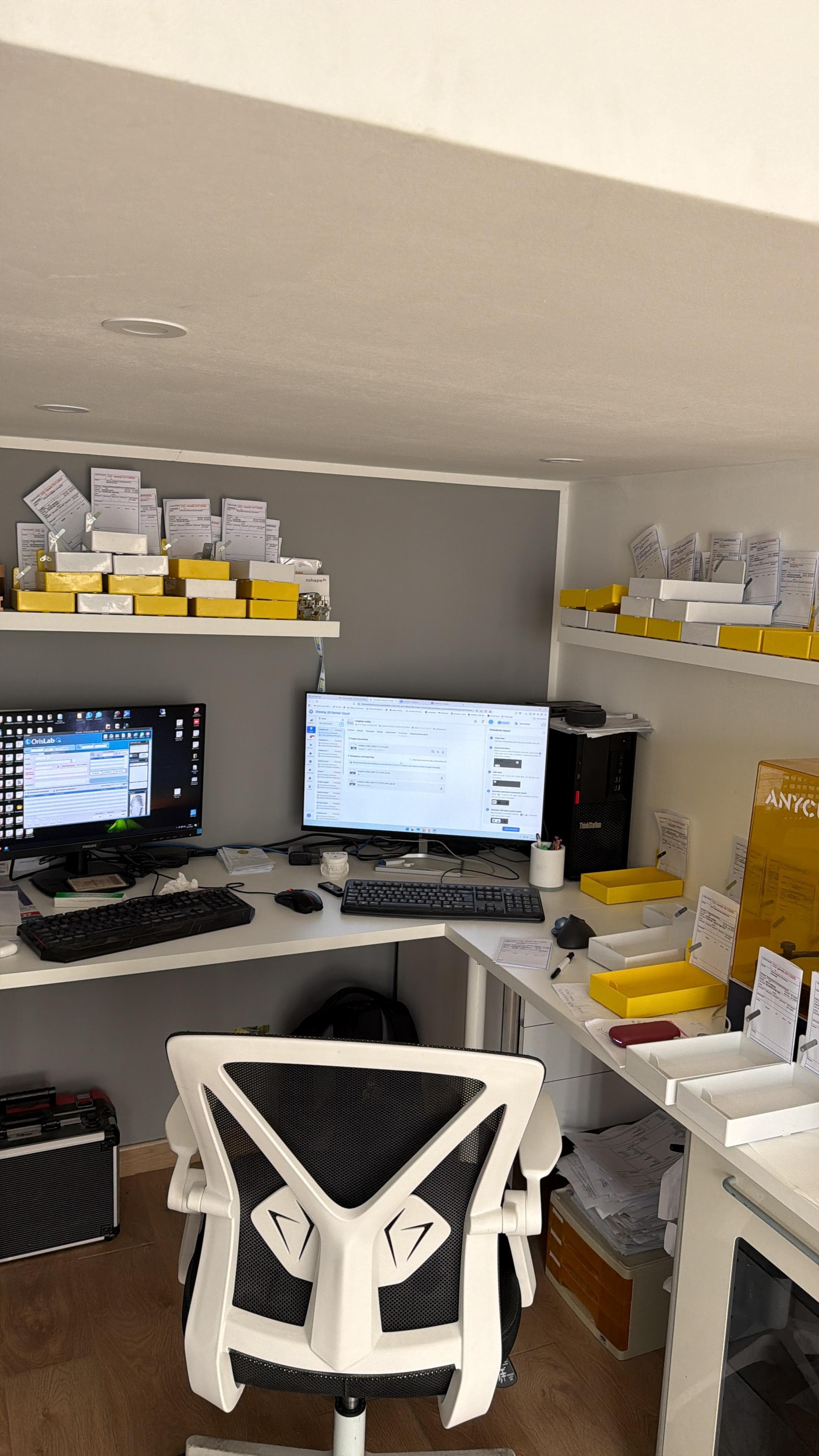 I banchi di lavoro del laboratorio con i vassoi dei casi in lavorazione